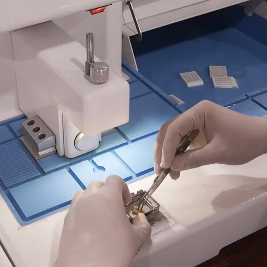 Centre de &icirc;ncorporare Mașină Medicală X Ray Audiometer Audiometru Monitor al glicemiei Monitorizarea portabilă Analiza centrelor de &icirc;ncorporare