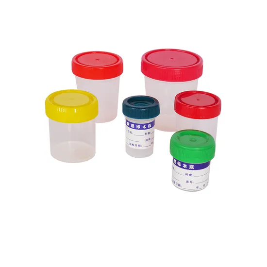 Instrument de laborator OEM OEM de &icirc;naltă calitate Analizator de hematologie Analizator de eșantion Petri